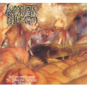 Torsofuck / Lymphatic Phlegm - Disgusting Gore And Pathology / Polymorphisms To Severe Sepsis In Trauma LP LTD ORANGE VINYL